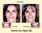 ZAHN-Behandlung CZ -günstiger als Ungarn/Polen/Bulgarien.